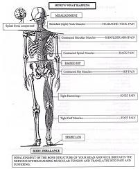 skeletal imbalance