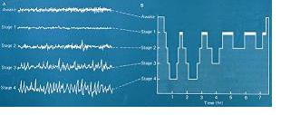 sleep stages